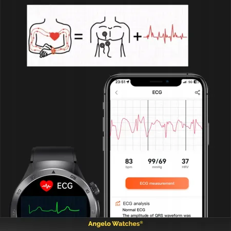 Smartwatch Męski Kardiowatch Angelo E800 czarny Pomiar Cukru EKG Rozmowy Menu PL Laseroterapia