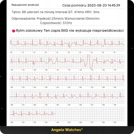 Smartwatch Zegarek Damski Kardiowatch Angelo AT200 srebrny Rozmowy Ciśnienie EKG HRV Menu PL