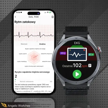 Smartwatch Męski Zegarek Angelo AT472 czarny Glukoza Rozmowy Ciśnienie EKG Amoled Puls Menu PL